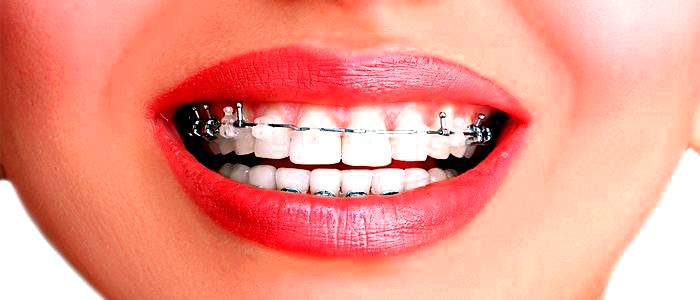 Протезирование зубов Николаев - преимущество и особенности услуги