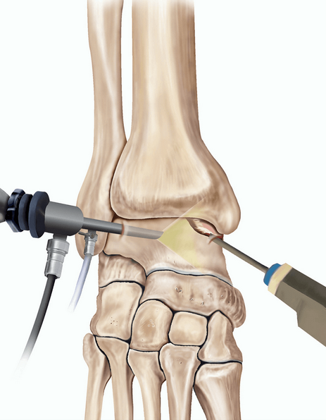 Операции на голеностопном суставе, колене, стопе и бедре